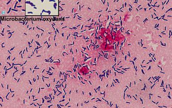Microbacterium oxydans Gram stain