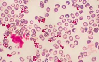 Micrococcus luteus Gram stain