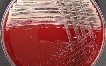 Micrococcus luteus Blood Agar 24h culture incubated with O2