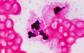 Micrococcus luteus Gram stain