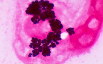 Micrococcus luteus Gram stain