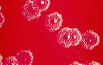 Moraxella atlantae Blood Agar 24h culture incubated with O2