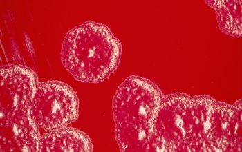 Moraxella atlantae Blood Agar 24h culture incubated with O2