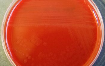 Moraxella atlantae Blood Agar 48h culture incubated with O2