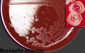 Moraxella atlantae Blood Agar 48h culture incubated with O2