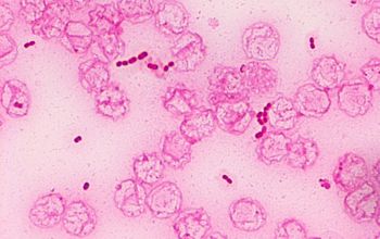 Moraxella atlantae Gram stain