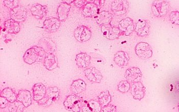 Moraxella atlantae Gram stain