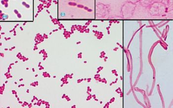 Moraxella atlantae Gram stain