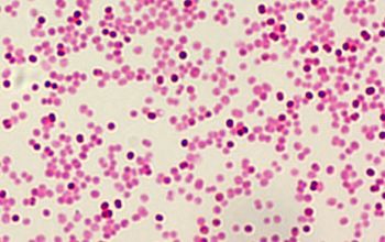 Moraxella catarrhalis Gram stain