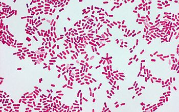 Moraxella nonliquefaciens Gram stain