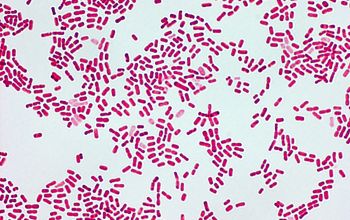 Moraxella nonliquefaciens Gram stain