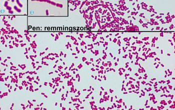 Moraxella nonliquefaciens Gram stain