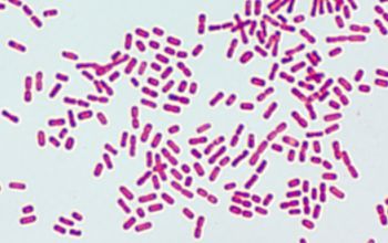 Moraxella nonliquefaciens Gram stain