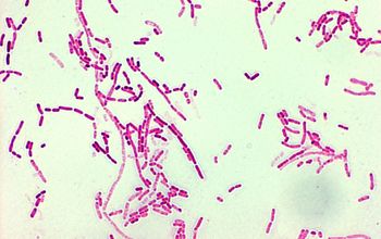 Moraxella osloensis Gram stain