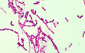 Moraxella osloensis Gram stain