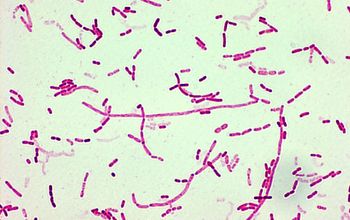 Moraxella osloensis Gram stain