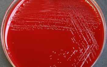 Moraxella osloensis Blood Agar 24h culture incubated with O2