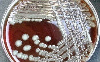 Morganella morganii Blood Agar 48h culture incubated with O2