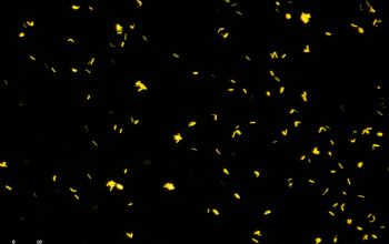 Mycobacterium abscessus Auramine stain