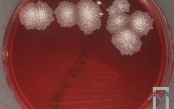 Mycobacterium abscessus (Mycobacteroides abscessus)( Blood Agar 48h culture incubated with CO2