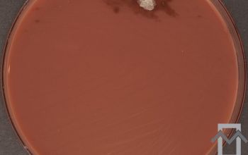 Mycobacterium abscessus (Mycobacteroides abscessus)( Chocolate Agar 48h culture incubated with CO2