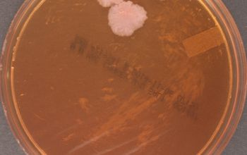Mycobacterium abscessus (Mycobacteroides abscessus)( Mac Conkey Agar without salt 48h culture incubated with CO2