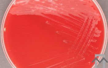 Mycobacterium abscessus (Mycobacteroides abscessus)( Blood Agar 24h culture incubated with CO2