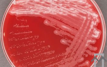 Mycobacterium abscessus Blood Agar 48h culture incubated with CO2