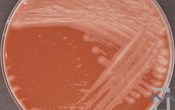 Mycobacterium abscessus (Mycobacteroides abscessus)( Chocolate Agar 48h culture incubated with CO2