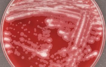 Mycobacterium abscessus  culture incubated with O2