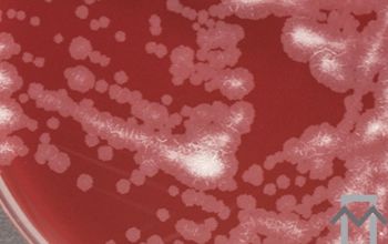 Mycobacterium abscessus (Mycobacteroides abscessus)(  culture incubated with O2