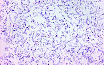 Mycobacterium chelonae (Mycobacteroides chelonae) Gram stain