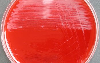 Mycobacterium chelonae (Mycobacteroides chelonae) Blood Agar 48h culture 