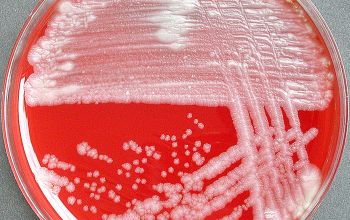 Mycobacterium chelonae (Mycobacteroides chelonae)  culture incubated with CO2