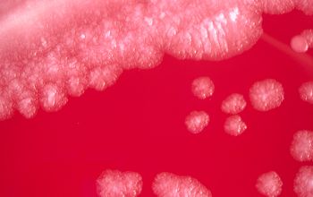 Mycobacterium chelonae (Mycobacteroides chelonae)  culture incubated with CO2