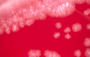 Mycobacterium chelonae  culture incubated with CO2