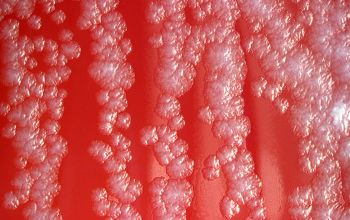 Mycobacterium chelonae  culture incubated with CO2