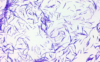 Mycobacterium chelonae (Mycobacteroides chelonae) Gram stain