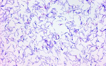 Mycobacterium fortuitum Gram stain