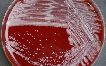 Mycobacterium fortuitum (Mycobacteroides fortuitum)  culture incubated with CO2