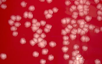 Mycobacterium fortuitum (Mycobacteroides fortuitum)  culture incubated with CO2