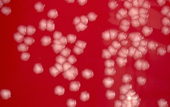 Mycobacterium fortuitum  culture incubated with CO2