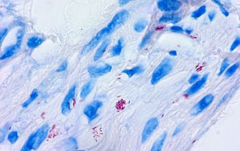 Mycobacterium leprae Ziehl Niessen stain