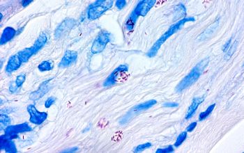 Mycobacterium leprae  culture 