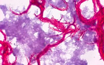 Mycobacterium tuberculosis Ziehl Niessen stain