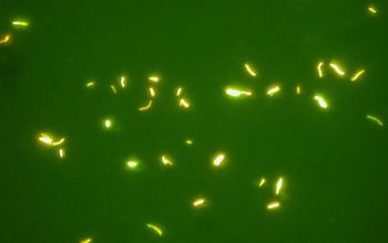 Mycobacterium tuberculosis Auramine stain