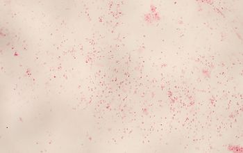 Mycoplasma hominis (Metamycoplasma hominis) Gram stain