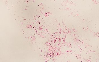 Mycoplasma hominis Gram stain