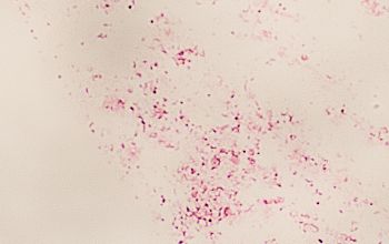 Mycoplasma hominis (Metamycoplasma hominis) Gram stain