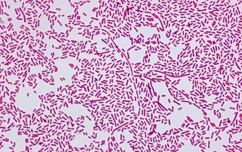 Myroides odoratus Gram stain